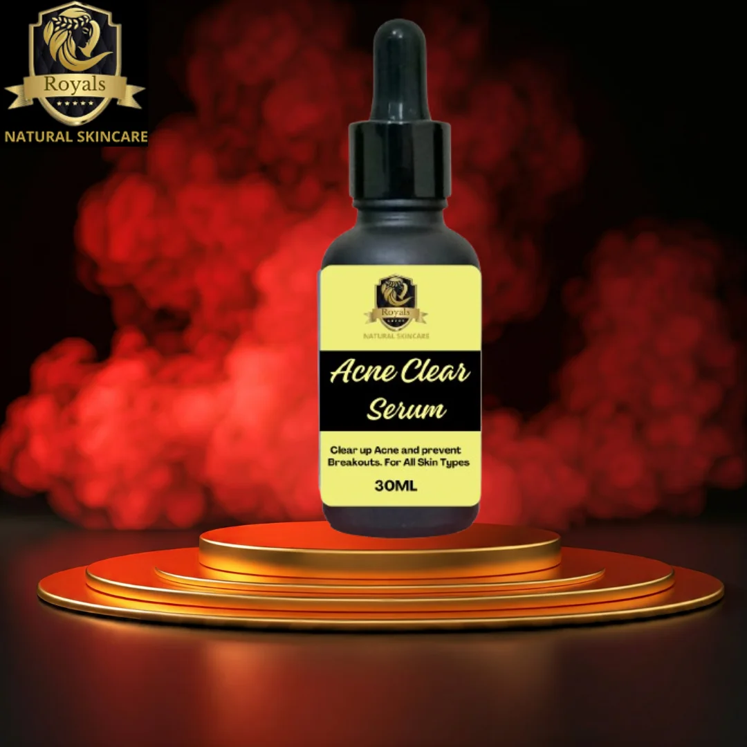 Royals Acne Clear Serum